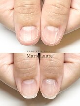 マリーロール 梅田店(Marie Laure)/自爪育成/深爪矯正/ネイルケア