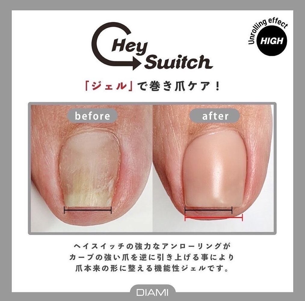 [フット]巻爪ケア2本韓国発［HeySwitch】ネイルケア&フットジェルワンカラ