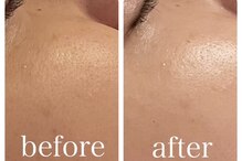 イルソーレ(IL Sole)