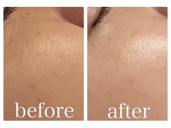 イルソーレ(IL Sole)