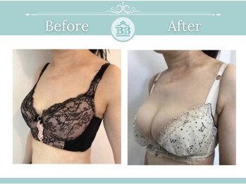 美人バスト 掛川店/【バストアップ/育乳静岡/掛川】