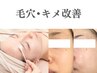 【お肌のキメ・毛穴改善】オーダーメイドピーリング60分 ￥25,000→￥15,000