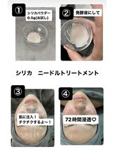 ビヌ(Binu)/シリカ注入ピール・初回