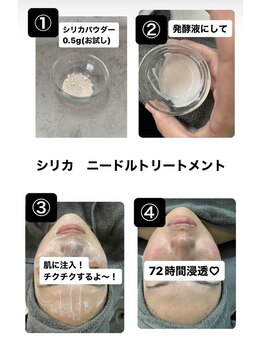 ビヌ(Binu)/シリカ注入ピール・初回