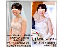 蒼(so)