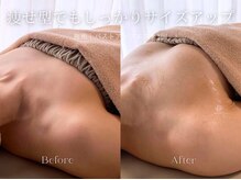 エメ(Aimee)の雰囲気(脂肪移動+コラーゲン生成で小胸さん・痩せ型さんもサイズUP★)