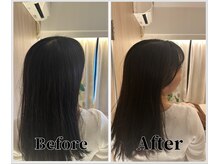 整体ラルース 中目黒(LALUZ)/30代 女性 ストレートネック改善