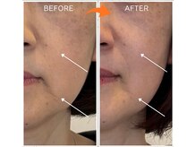 ミルアカ(Milu'aca)の雰囲気（頭×顔×背中の三点アプローチで顔と身体を同時ケア！）