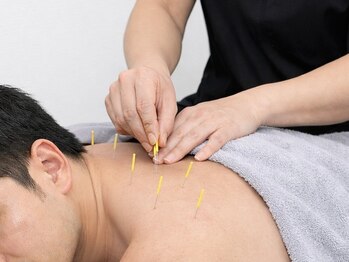 小林はり灸の写真/【男性のお客様も多数ご来店！】30代からの疲労と肩こりに、自律神経から整える男性向け本格鍼灸