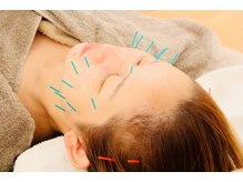 てらの鍼灸院 整体院の雰囲気(美容鍼灸に特化したスタッフが施術いたします。)