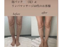 ルル(LuLu)/フットリンパマッサージ