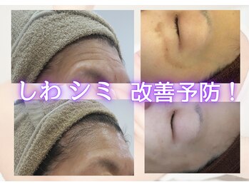 リヴェーヌ 呉羽店(Riverne)の写真/中々変化が実感しない方へ朗報!生コラーゲンでシミしわ改善予防ケア!