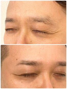 アイビー 人形町店(i.b)/眉【before⇒after】５５