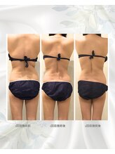 コンビンス(convince)/痩身ダイエットメニュー