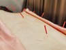 鍼灸施術