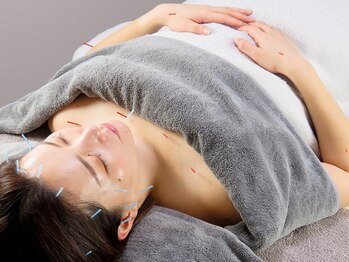 キュアボディ(Cure Body)の写真/≪新富町徒歩3分≫大人女性の美容鍼◎『たるみケア、シワケア、ほうれい線』など年齢による悩みに◎