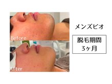 メンズビオ 神戸三宮店/