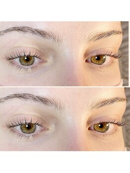 アトモス サニーテラス(Atmos sunny terrace)/ラッシュリフト　韓国ロッド　