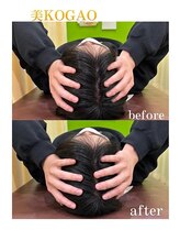 千里山わだち整骨院/美小顔矯正ビフォーアフター