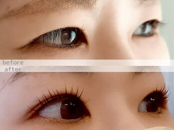 エフ(F...)/まつパbefore →after