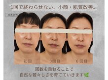 エクラヴィ(Eclatvie)の雰囲気（回数を重ねるたび、自然な変化を実感される方が多数。）
