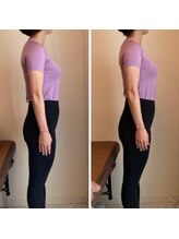 エスアップ 麻布十番店(THE S-UP)/施術前後写真