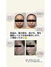 肌や髪のお悩み相談