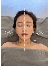 インディバ サロン S/お客様 Before→After
