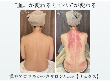 リュクス(Luxe)の写真