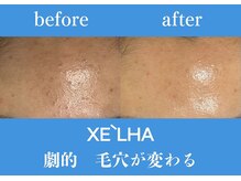 パールホワイトニングサロン 小田原店/ノーファンデでも毛穴がないお肌