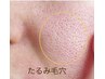 【リフトアップ専門】たるみに効果◎幹細胞トリートメント×マッサージ