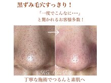 カミーシャ(KaMi-Sha)の雰囲気（触りたくなっちゃう♪何度も見たくなっちゃうつるん毛穴♪）