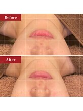 AK エステティックス(AK Esthetics)