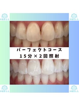 シェル(SHELL)/パーフェクトコース