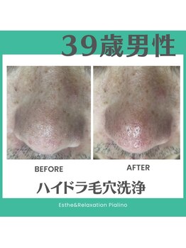 ピアリーノ(Pialino)/