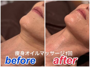 シイ(She)/痩身オイルマッサージ