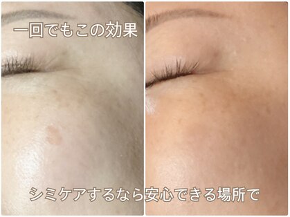 ビューティーサロン トゥワイス(TWICE)の写真