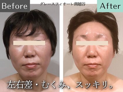 グレースフィオーレ 南越谷店(gracefiore)の写真