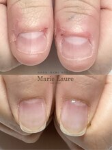 マリーロール 梅田店(Marie Laure)/自爪育成/深爪矯正/ネイルケア