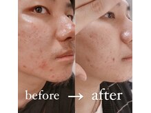 クレール 小山店(CLAIR)/【ラジオ波】