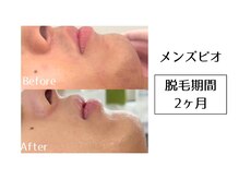 メンズビオ 神戸三宮店/