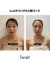 Instagram小顔★《WINBACK首肩凝り＆小顔＆頭蓋骨矯正》80分通常¥25000円→
