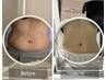 劇的痩身【結果重視】短期集中×2ヶ月後の私が変わる！本気痩せ100分体験