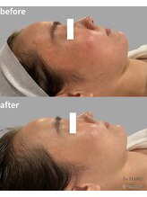 バイハル 原宿表参道(by HARU)/before＆after