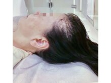 イーズ/リバイタ グランツリー武蔵小杉店/【ケース2】60代女性　before