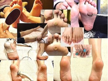 ビサンテ サロンの写真/角質ケア&特許,角質育成ケアで魚の目/タコ/ガサガサ足裏,カカト,ツルプル!爪ケア,足バランス美脚,全身人気!