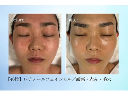 デディア 恵比寿(dedia)の写真