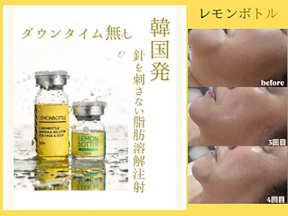 ルアナ(Ruana)の写真