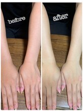 アロマ&クレイケアルーム ネロリドール(Nerolidol)/クレイハンドパック