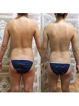 エテルノ(eterno)/猫背と骨盤矯正で背中スッキリ